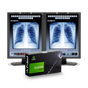 NEC Bundle with two MD211C3 and MDN-K2000 - FDA 510(k) Cleared