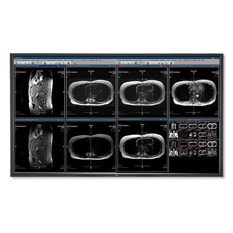 55" Color 8-Megapixel Medical Clinical Display